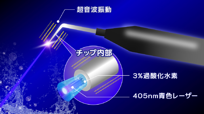 ブルーラジカル治療とは？